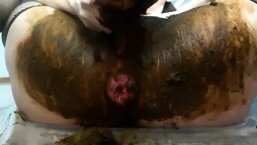 ScatLina - Anal prolapse in shit