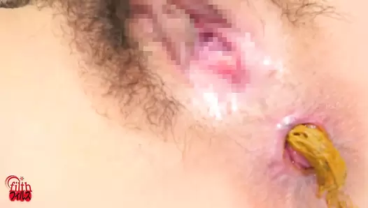 FF-659 01 Super detailed footage of womens anuses producing poop