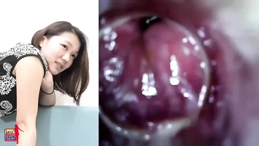 BFH-176 02 Her most embarrassing hole. VOL. 6