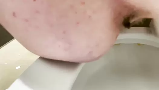 FreckledRED - Pooping Compilation