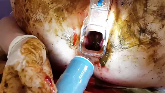 AnnaCoprofield - Period, speculum and filled pussy