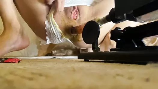 p00girl - Anal with a fucking machine, shit in the pussy