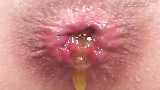 UNKW-063 05 Close-up shots of female defecation! Remastered Exodus Gold and OPERA series. (Uncensored) #5