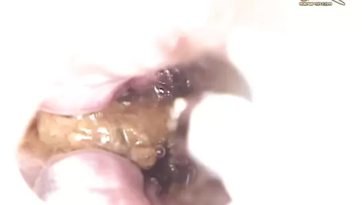 UNKW-063 04 Close-up shots of female defecation! Remastered Exodus Gold and OPERA series. (Uncensored) #5