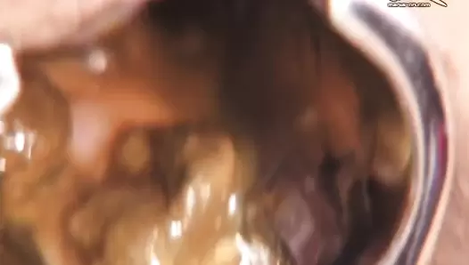UNKW-063 04 Close-up shots of female defecation! Remastered Exodus Gold and OPERA series. (Uncensored) #5