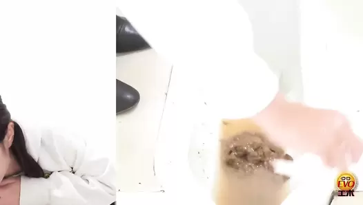 EE-465 02 Toilet voyeur: anal opening diarrhea stool shows all things in the intestines
