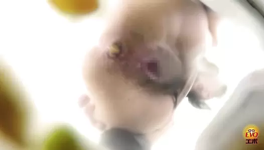 EE-465 01 Toilet voyeur: anal opening diarrhea stool shows all things in the intestines