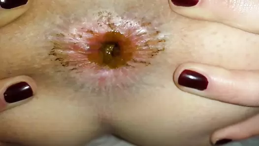 AnnaCoprofield - Quickly shit in the morning and the beginning of menstruation