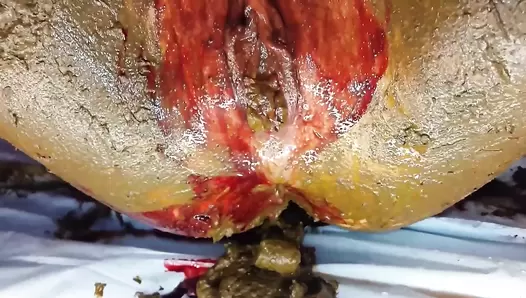 AnnaCoprofield - Shit and Blood Vol.6 Filled Pussy