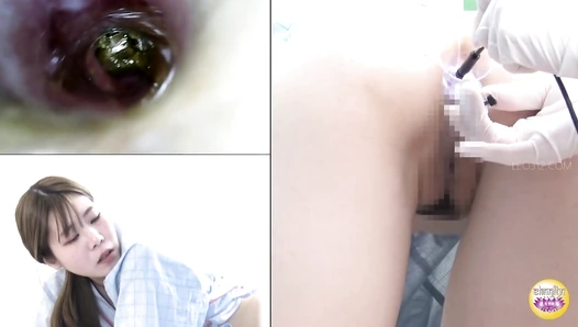SL-625 03 Hidden camera at the constipation relief clinic. Stimulating the intestines of a woman with a stuck turd. VOL. 4